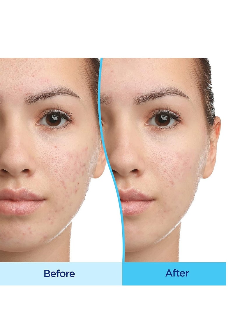 differin Multicolor acne treatment gel 15g  - Image 2