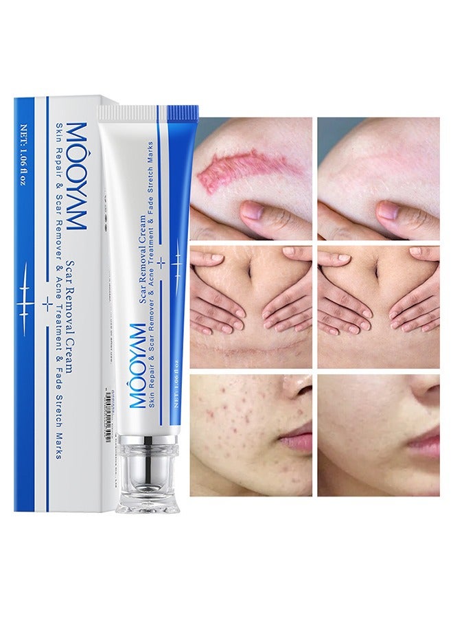 MOOYAM Scar Removal Cream-Skin Repairing Cream Fade Scars/Stretch Marks/Acne Treatment, Improve Scar Skin, Deeply Moisturizes Skin-30ml  - Image 1