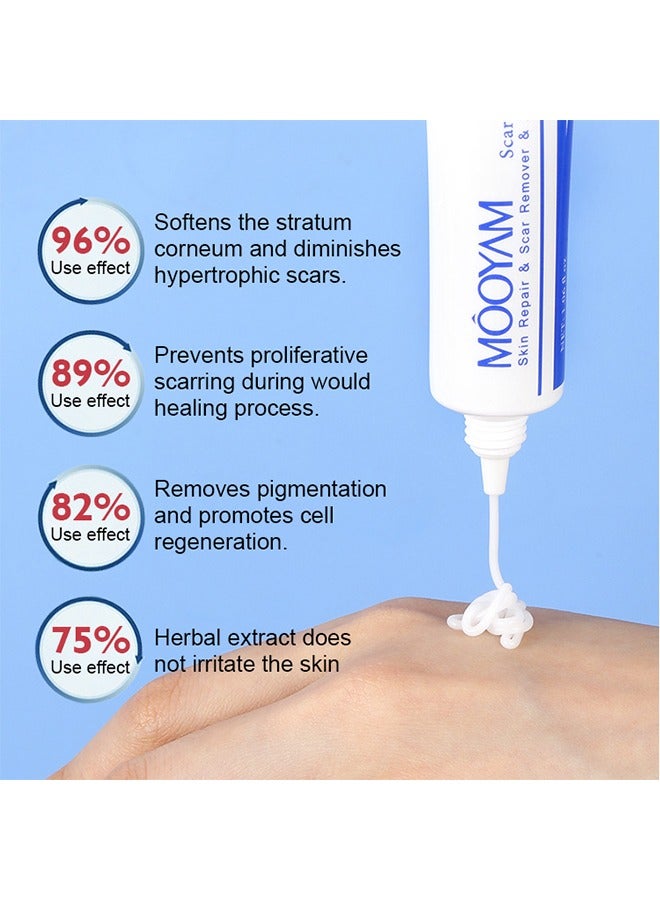 MOOYAM Scar Removal Cream-Skin Repairing Cream Fade Scars/Stretch Marks/Acne Treatment, Improve Scar Skin, Deeply Moisturizes Skin-30ml  - Image 5