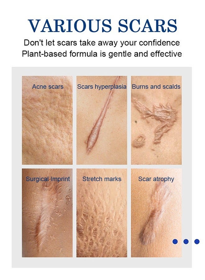 MOOYAM Scar Removal Cream-Skin Repairing Cream Fade Scars/Stretch Marks/Acne Treatment, Improve Scar Skin, Deeply Moisturizes Skin-30ml  - Image 3