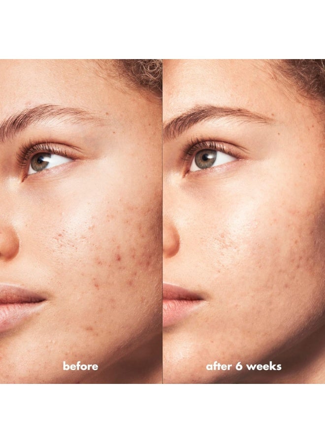 elf Skin Blemish Breakthrough Acne Calming Water Cream Lightweight Acne-Fighting Face Moisturiser - Image 2