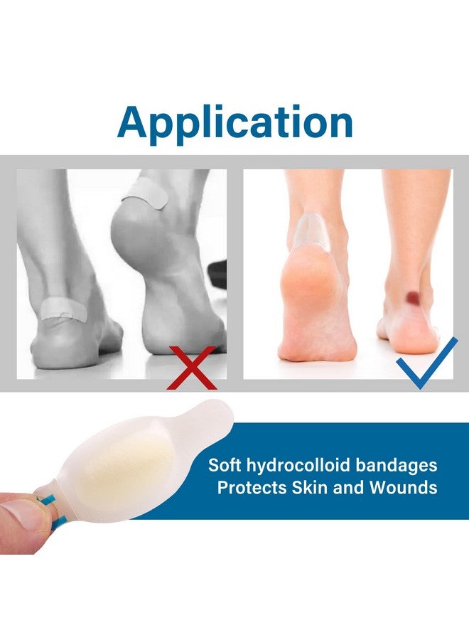 LotFancy Blister Bandages For Feet, 24 Blister Pads And 12 Acne Patches, 8 Size Gel Blister Cushion Variety Pack, Waterproof Seal Hydrocolloid Bandage For Toes Protection, Heel Blister Prevention - Image 1