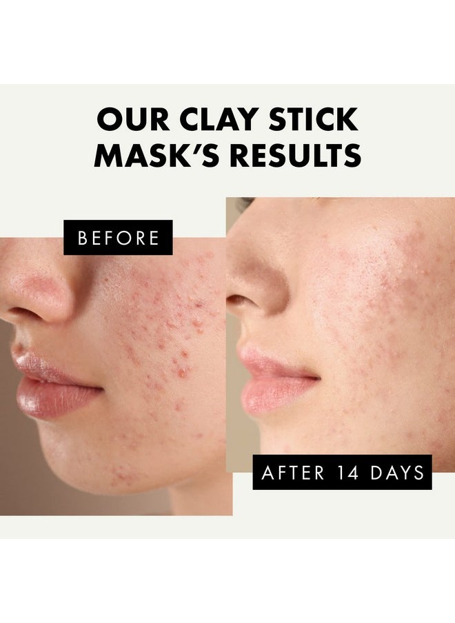 Nourishing Clay Stick Mask For Clearer Brighter And Hydrated Skin Unclog Pores And Removes Blackheads With Detoxifying Kaolin Clay And Caffeine 1.4 Oz