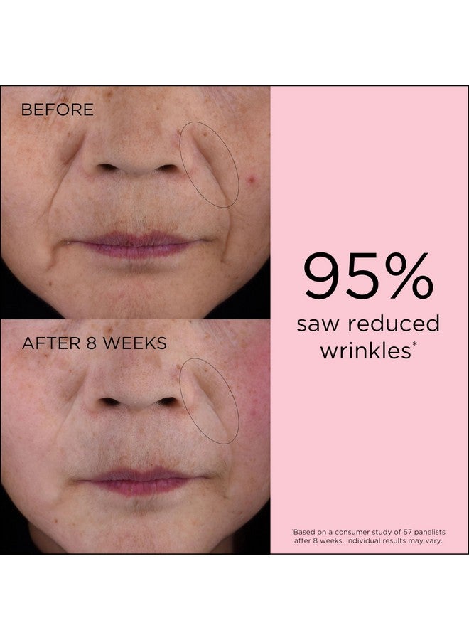 Elizabeth Arden Retinol + Hpr Ceramide Capsules, Anti-Aging Skin Renewing Serum, Skincare Gift For Women, Reduces Fine Lines & Wrinkles - Image 3