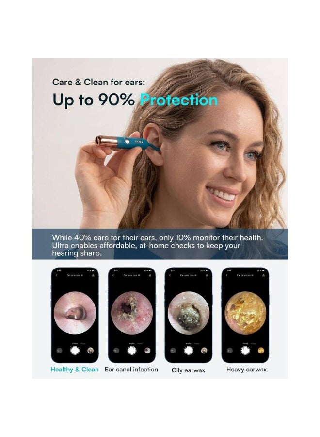 Bebird EarSight Ultra Visual Earwax Removal Kit with 2K HD Camera, Wi-Fi App & Precision Cleaning Tools - Image 5