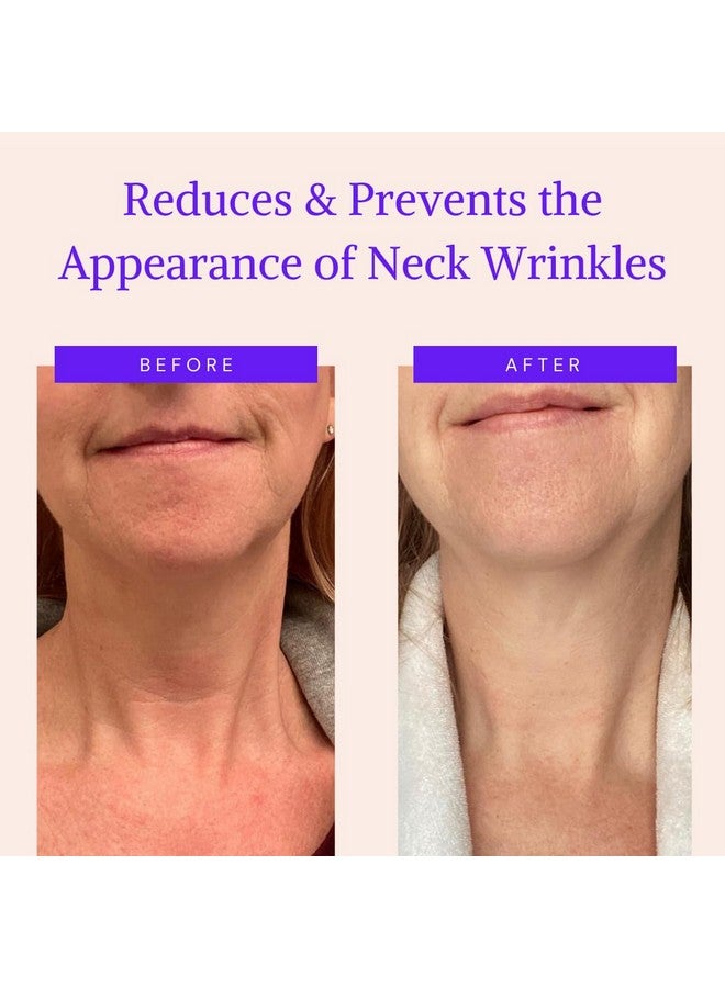 BLUMBODY Neck Wrinkle Patches - Advanced Anti Aging Neck Wrinkle Pads for More Visible Skin Firming & Neck Tightening - Overnight Reusable Silicone Wrinkle Patches - Crepe Erase & Neck Lift (2-mo Supply) - Image 2