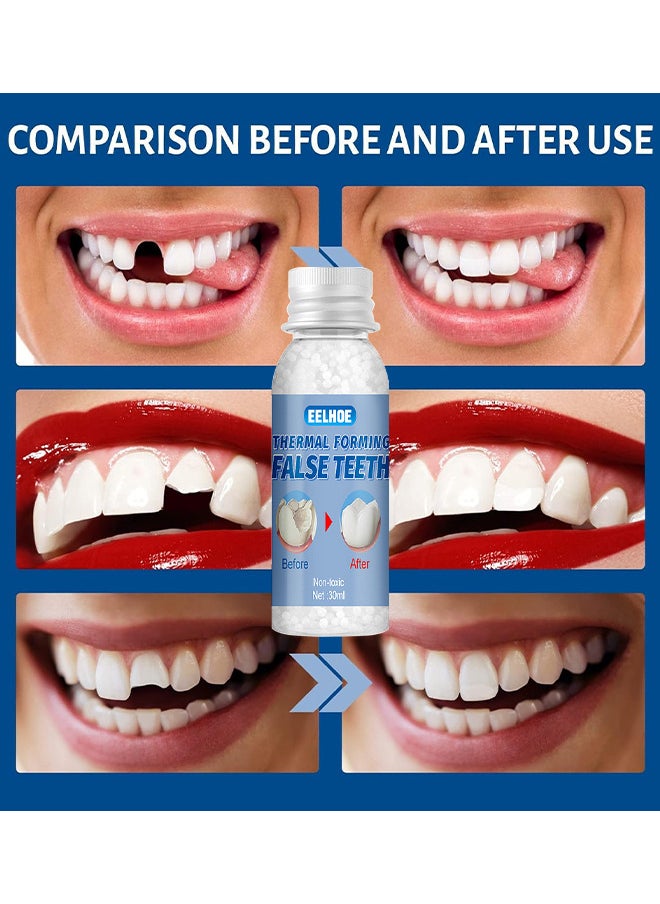 EELHOE - Temporary Tooth Repair Beads Tooth Repair Kit Teeth Filling Replacement For Chipped Teeth, Thermal Beads For Temporary Fix The Missing And Broken Tooth Fake Teeth 30ML - Image 1