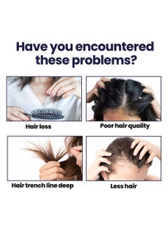 OUHOE 2 Pcs Hair Growth Spray Strengthens Hair And Rejuvenates  - Image 4