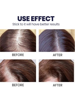 OUHOE 2 Pcs Hair Growth Spray Strengthens Hair And Rejuvenates  - Image 5