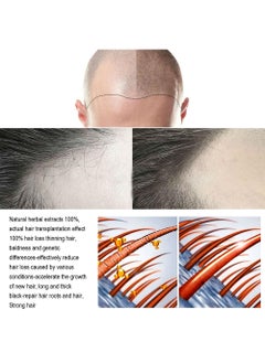 OUHOE 2 Pcs Hair Growth Spray Strengthens Hair And Rejuvenates  - Image 3