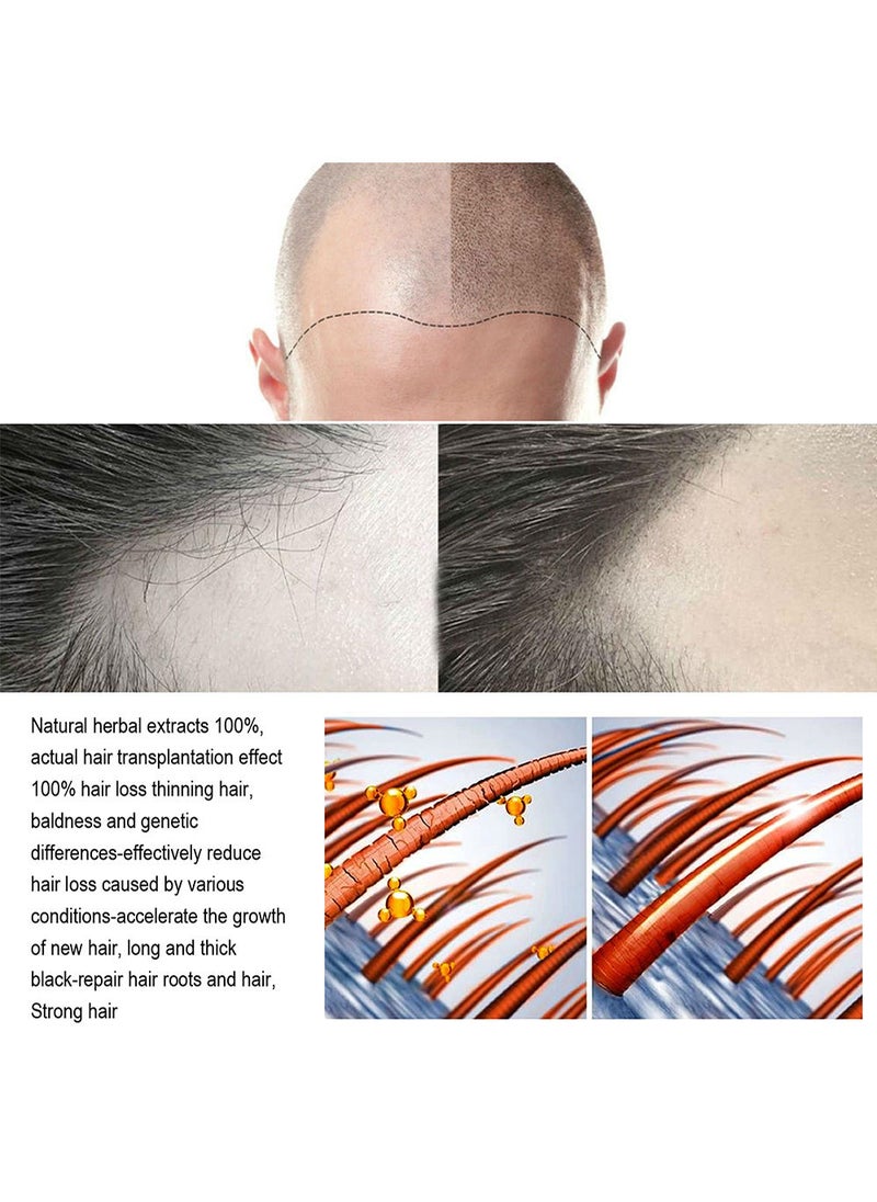 OUHOE - 2 Pcs Hair Growth Spray Strengthens Hair And Rejuvenates - Image 1