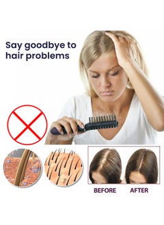 OUHOE 2 Pcs Hair Growth Spray Strengthens Hair And Rejuvenates  - Image 2