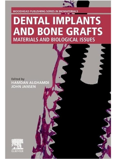 Dental Implants and Bone Grafts: Materials and Biological Issues By Hamdan Alghamdi ,John Jansen