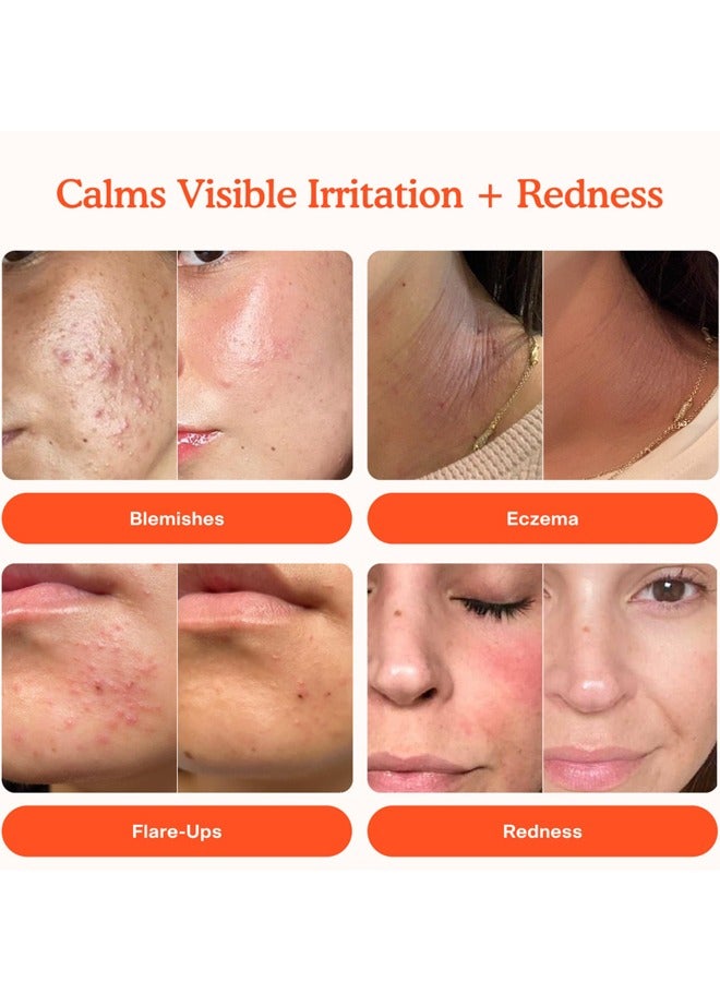 Tower 28 SOS Daily Rescue Facial Spray for Sensitive Skin, Hypochlorous Acid Spray Helps Reduce Redness and Breakouts, Full Size Toner for Face, 4 FL Oz - Image 2