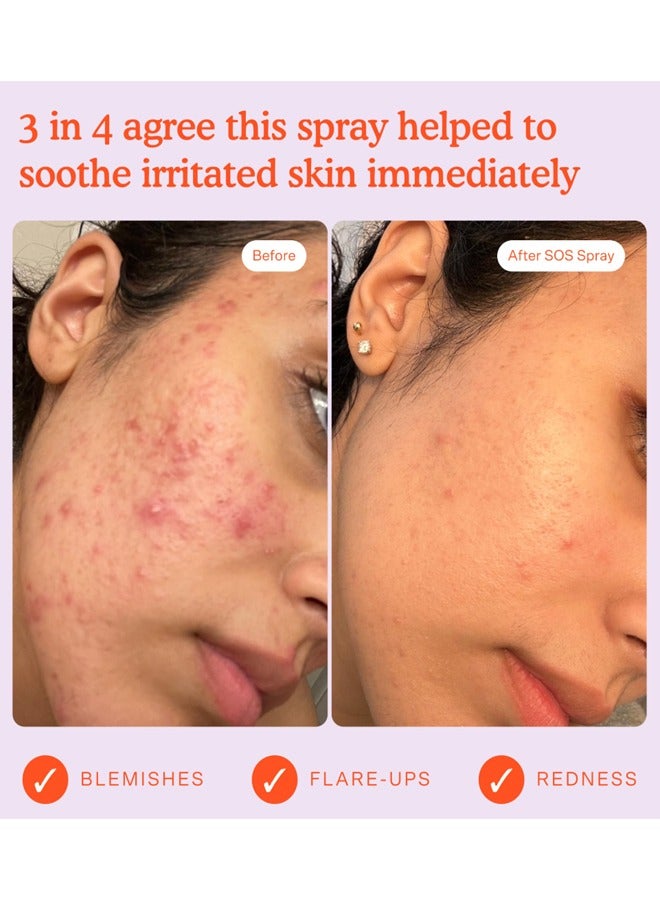 Tower 28 SOS Daily Rescue Facial Spray for Sensitive Skin, Hypochlorous Acid Spray Helps Reduce Redness and Breakouts, Full Size Toner for Face, 4 FL Oz - Image 3