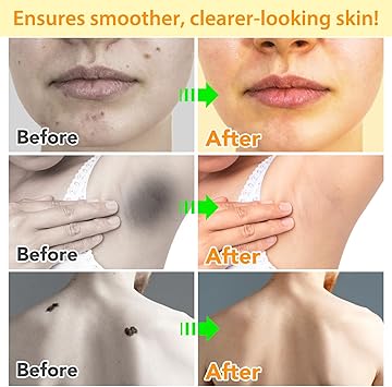 TailaiMei Bee Venom Cream Bee Venom Mole and Wart Cream Bee Venom Wart and Tag RemoverProfessional Bee Venom Repair Cream for All Parts of The Body - Image 4