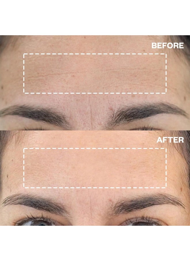 WRINKLES SCHMINKLES - Forehead Wrinkle Patches, 4-Pack, Reusable Hypoallergenic Silicone Smoothing Pads For Reducing Frown Lines & Face Lift Overnight - Image 1