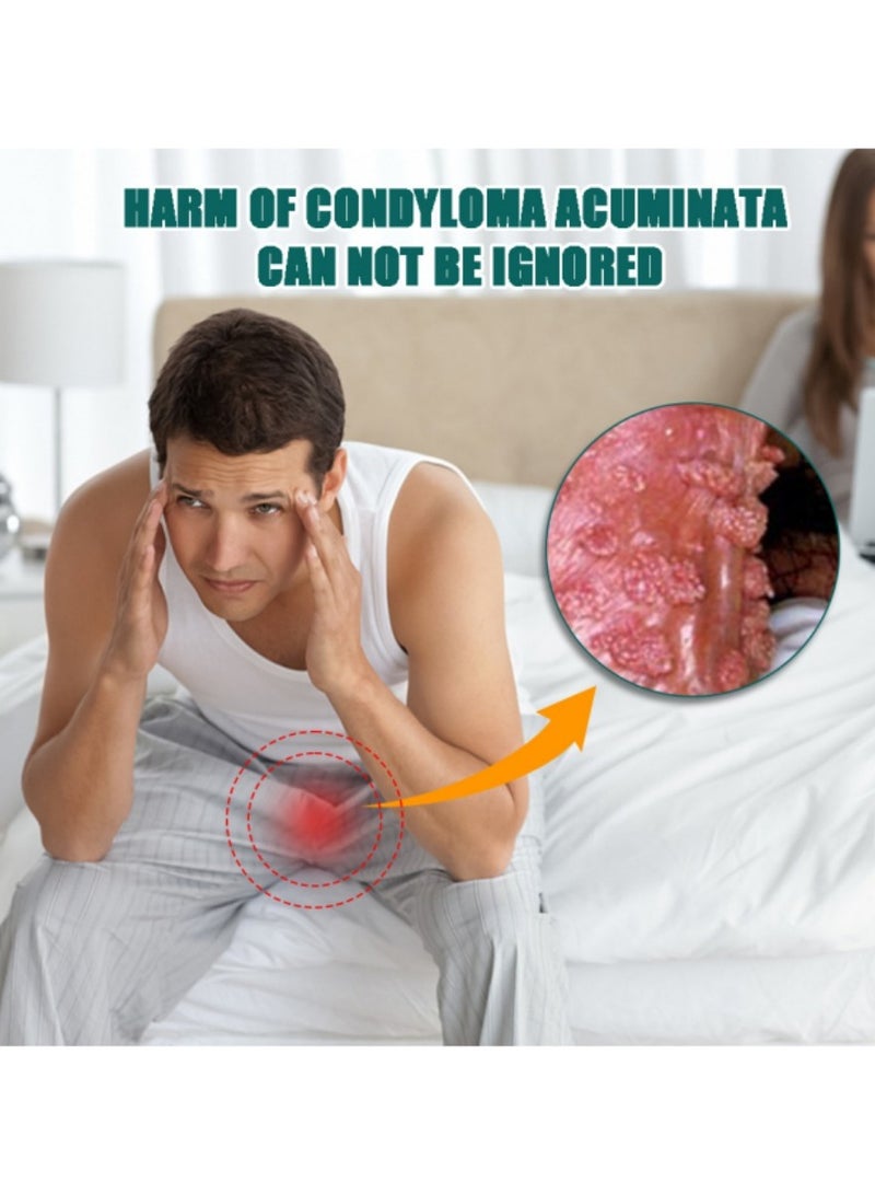 سوميفون مرهم إزالة الثآليل، محلول إزالة الثآليل، كريم إزالة الثآليل، كريم إزالة الثآليل المحمول اللطيف الآمن مع مستخلصات طبيعية لجميع أنواع البشرة، عالمي لكل من الرجال والنساء لإزالة الثآليل. حماية الصحة والجمال. - Image 4