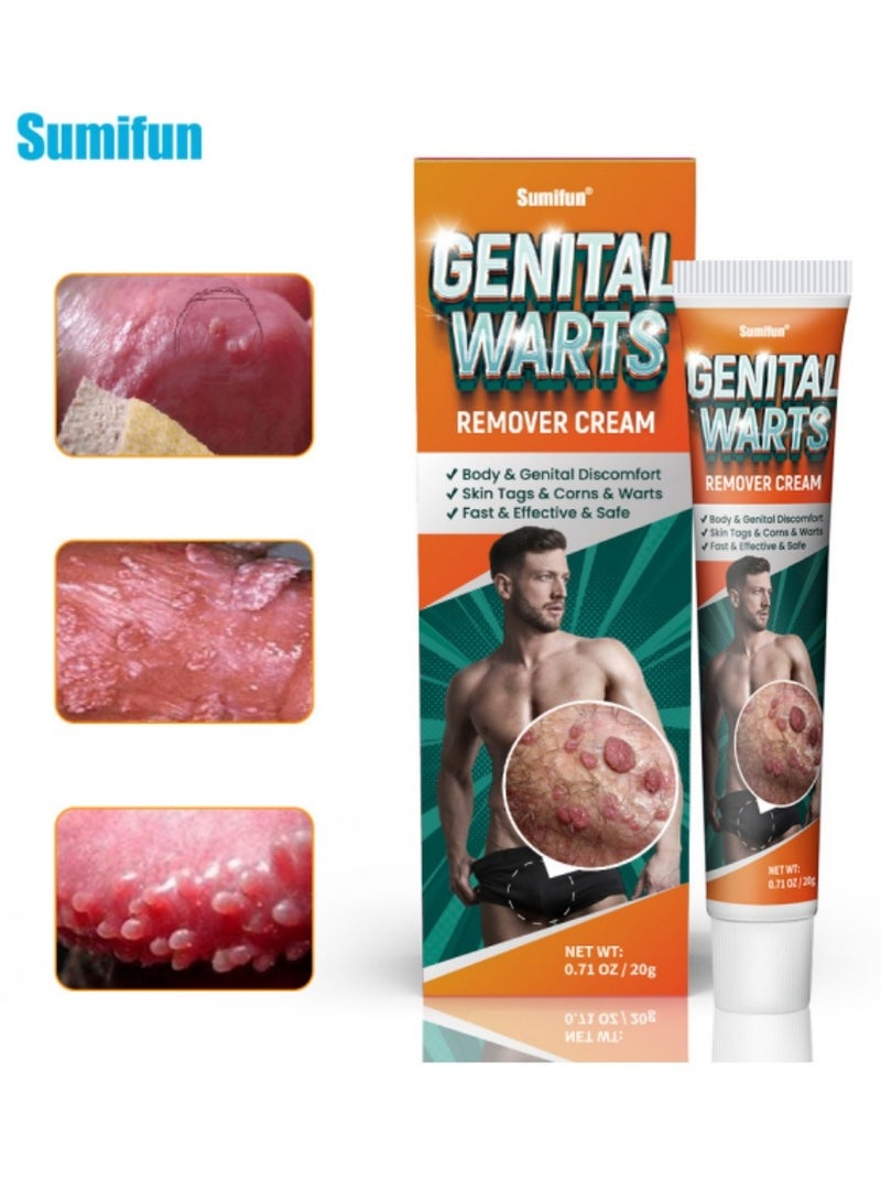 سوميفون مرهم إزالة الثآليل، محلول إزالة الثآليل، كريم إزالة الثآليل، كريم إزالة الثآليل المحمول اللطيف الآمن مع مستخلصات طبيعية لجميع أنواع البشرة، عالمي لكل من الرجال والنساء لإزالة الثآليل. حماية الصحة والجمال. - Image 2