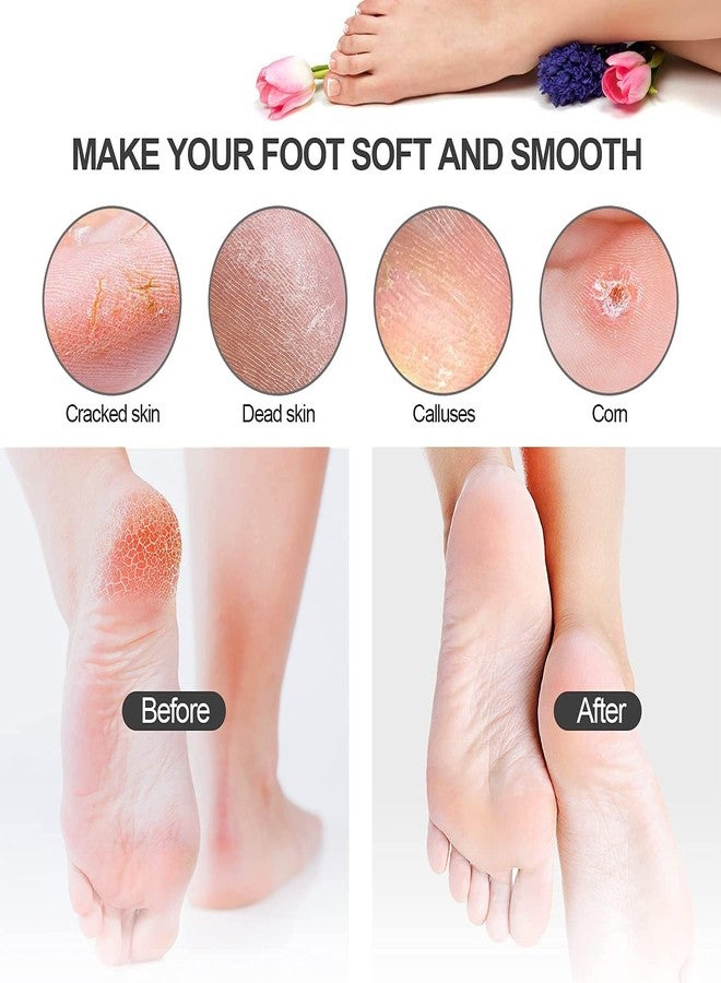 KIRA Professional Dual Sided Foot Scrubber,Filer with Steel and Emery Pad. Hard and Dead Skin Callus Remover, Pedicure Foot Scraper for Men and Women (A-400) - Image 3