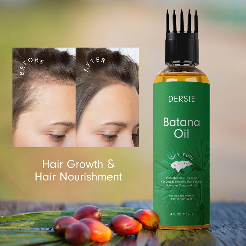 Dersie Batana Oil with Massager Applicator: Organic Batana Oil from Honduras - 100% Pure & Natural (4 fl oz) - Image 5