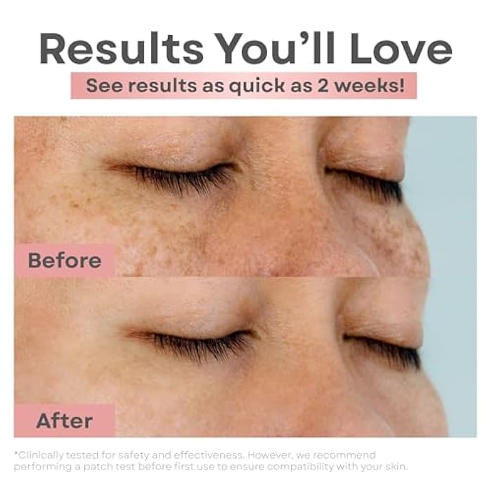 Clear Essence Brightening Dark Spot Serum Wand 0.34oz with Rollerball, Vitamin C Serum for Face, Acne Marks & Hyperpigmentation Treatment, Skin Lightening & Face Glow Corrector for Radiant Skin - Image 3