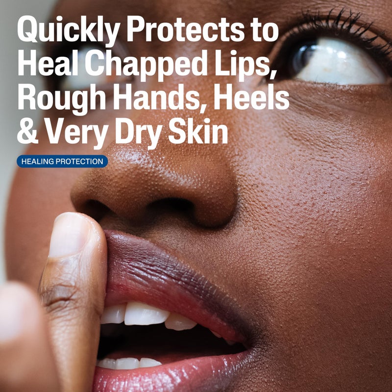 Cetaphil مرهم سيتافيل الشافي، 3 أونصات، للبشرة الجافة والمتشققة والمتهيجة، يشفي ويحمي، يهدئ اليدين المتشققتين والشفتين المتشققتين، مضاد للحساسية، خالي من العطور، موصى به من قبل الأطباء كعلامة تجارية للعناية بالبشرة الحساسة - Image 4