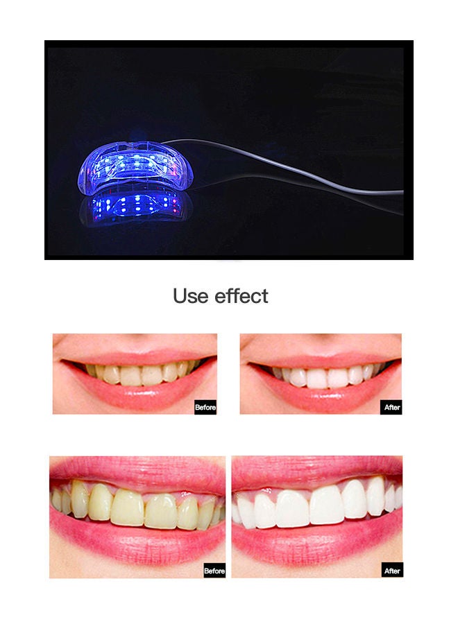 Tooth Whitening Instrument Line Lamp Set with 4 Carbamide Peroxide Gel Pens - 16-Minute Non-Sensitive Fast Teeth Whitener for Stain Removal
