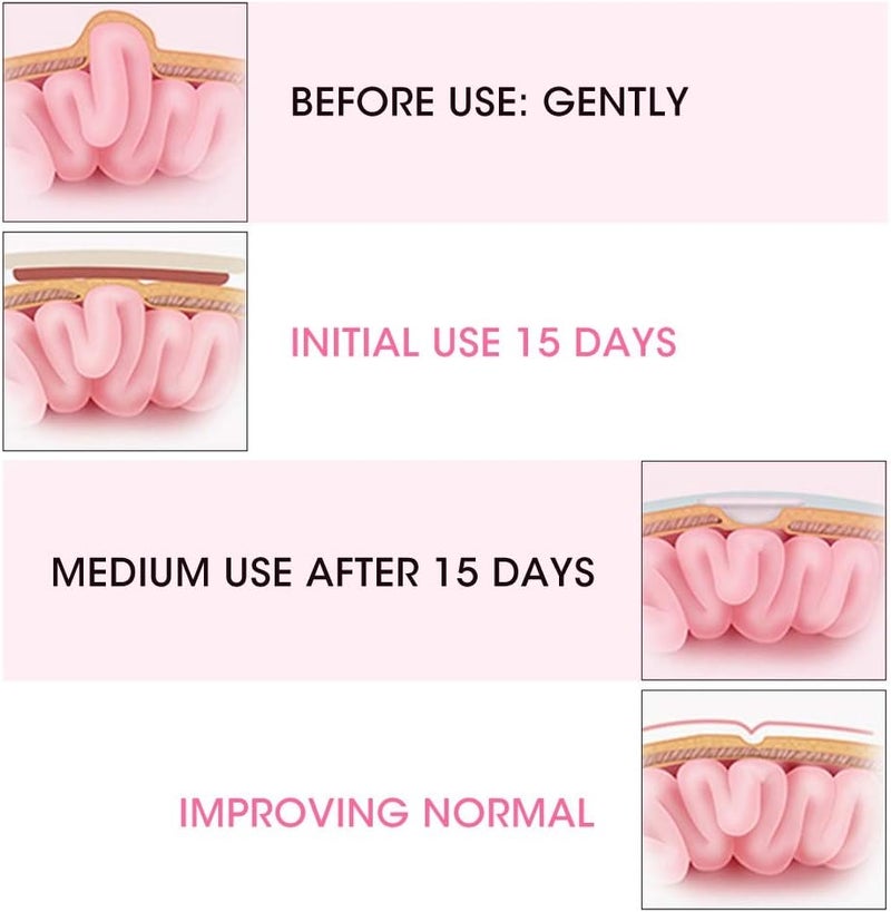 klarako Umbilical Hernia Belt, 2pcs Cotton Baby Infant Umbilical Cord Belly Band Newborn Navel Belt Umbilical Cord Kids Support Wrap Protector(Pink) - Image 3
