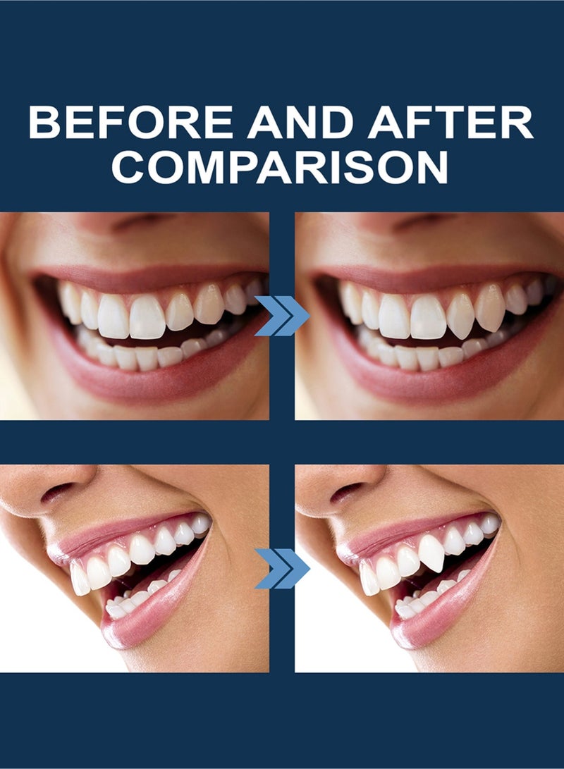 EELHOE Temporary Tooth Set with 4 Dental Tools, Easy to Use Moldable Teeth Replacements Kit for Fixing, Rooth, Broken Tooth Repair Kit 30ML - Image 3