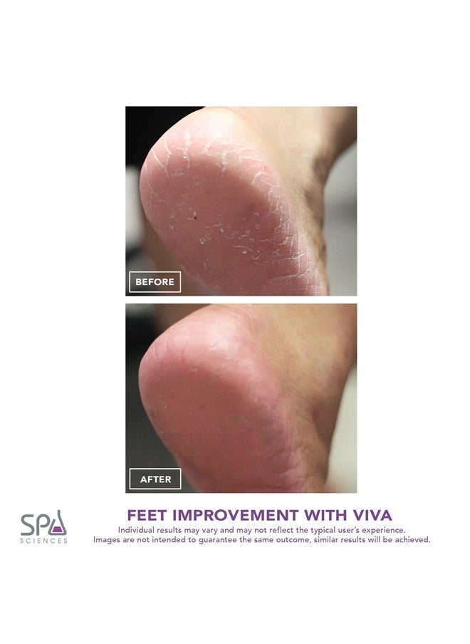 SPA SCIENCES Spa Sciences VIVA Most Powerful Pedicure Tool Available-Professional Electronic Foot Smoothing Pedi Tool for Removing Hard, Dry, Cracked Skin/Calluses on Feet, Rechargeable-2 Treatment Heads Included  - Image 4