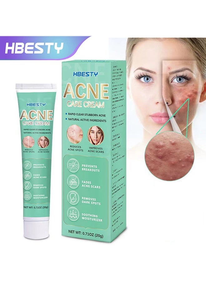 HBESTY Acne Care Cream, Acne Treatment Face Cream，Oil Control Anti Acne Facial Care ，Acne Spot ，Cystic Acne，Fungal Acne ，Face Acne Spot Treatment and Acne Scar Treatment Post Acne Marks Treatment，Pimple Remover， Acne Repair - Image 1