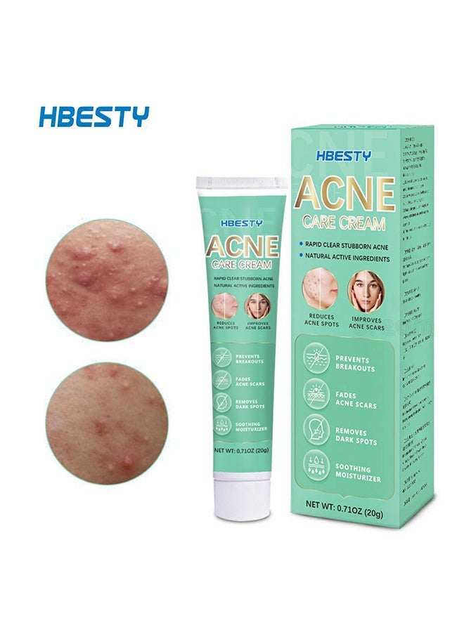 HBESTY Acne Care Cream, Acne Treatment Face Cream，Oil Control Anti Acne Facial Care ，Acne Spot ，Cystic Acne，Fungal Acne ，Face Acne Spot Treatment and Acne Scar Treatment Post Acne Marks Treatment，Pimple Remover， Acne Repair - Image 3