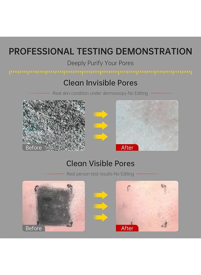 KOEC Amino Acid White Mud Doubie Care Facial Cleanser，Gentle Exfoliating Face Wash for Deep Pore Cleanser and Blackhead Removal, Facial Cleanser for Oily Skin & Sensitive Skin - Image 3