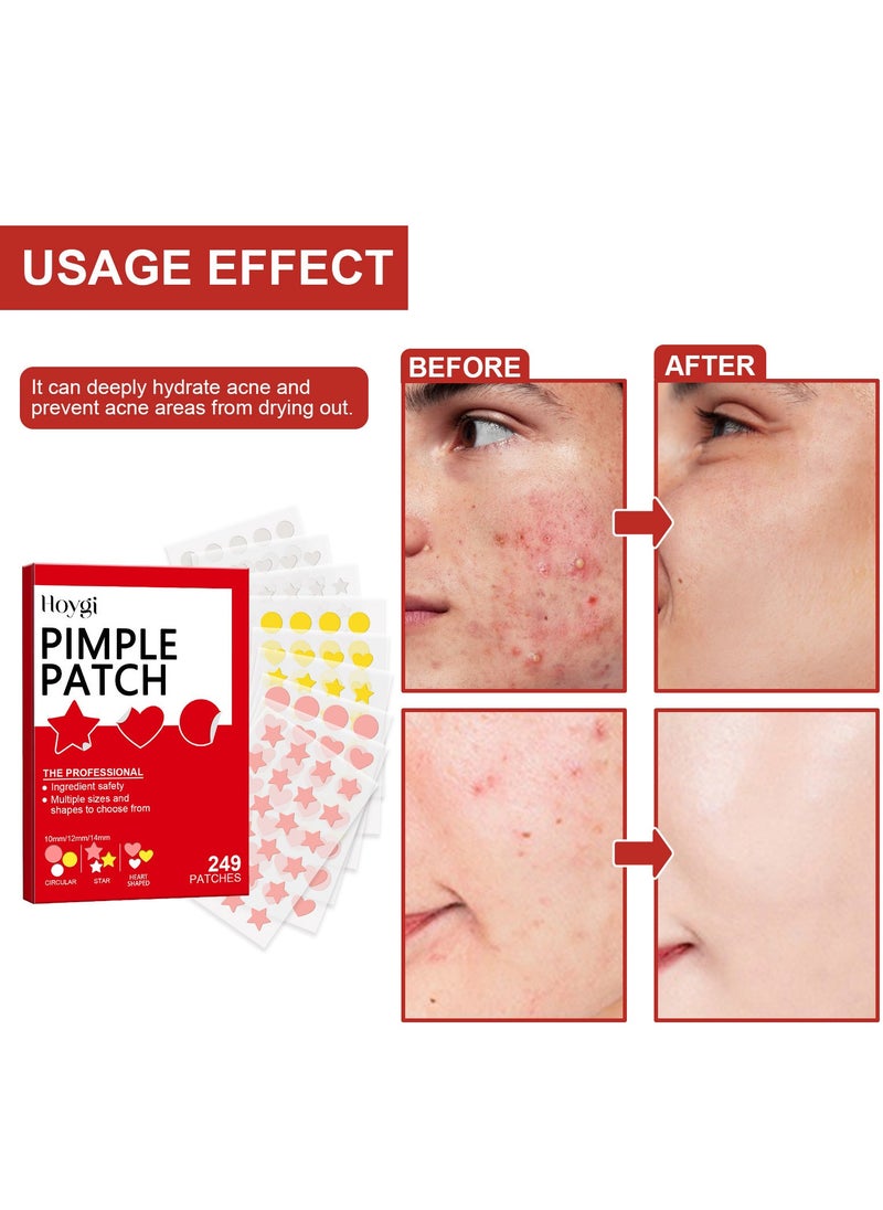 Hoygi 249 PCS Pimple Patches for Face, Acne Patches Hydrocolloid, Cute Star Zit Covers for Face, Spot Stickers with Tea Tree, Salicylic Acid & Cica Oil| Round, Star, Peach Shapes  - Image 3