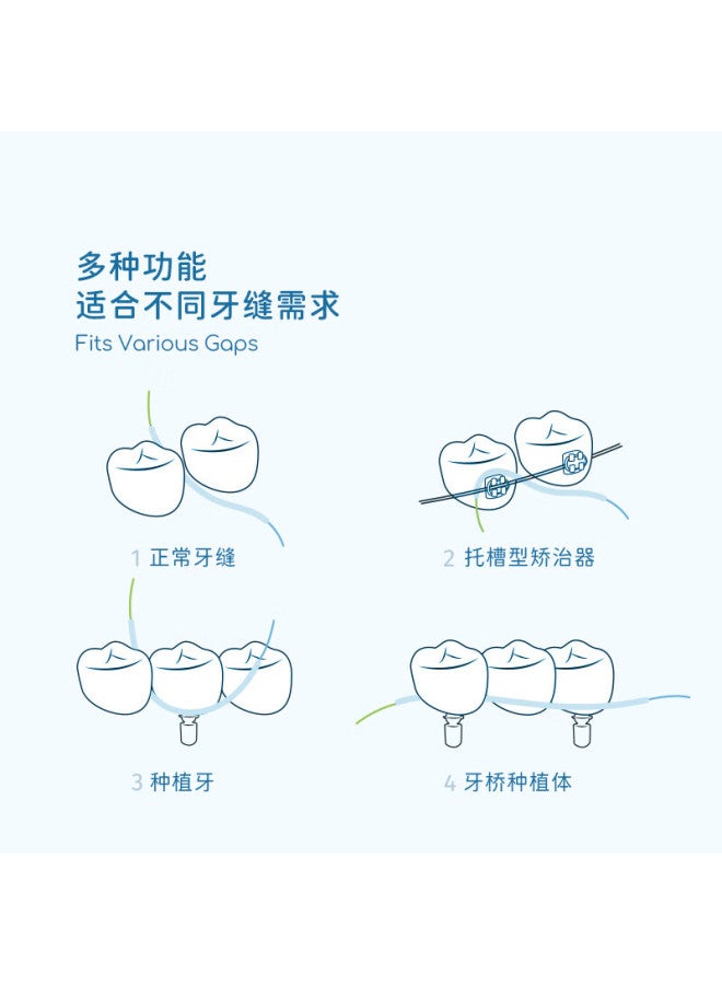 Tonochi Italian Imported Orthodontic Implant Dental Floss With Traction Line Multifunctional Expandable Fine Dental Floss Roll
