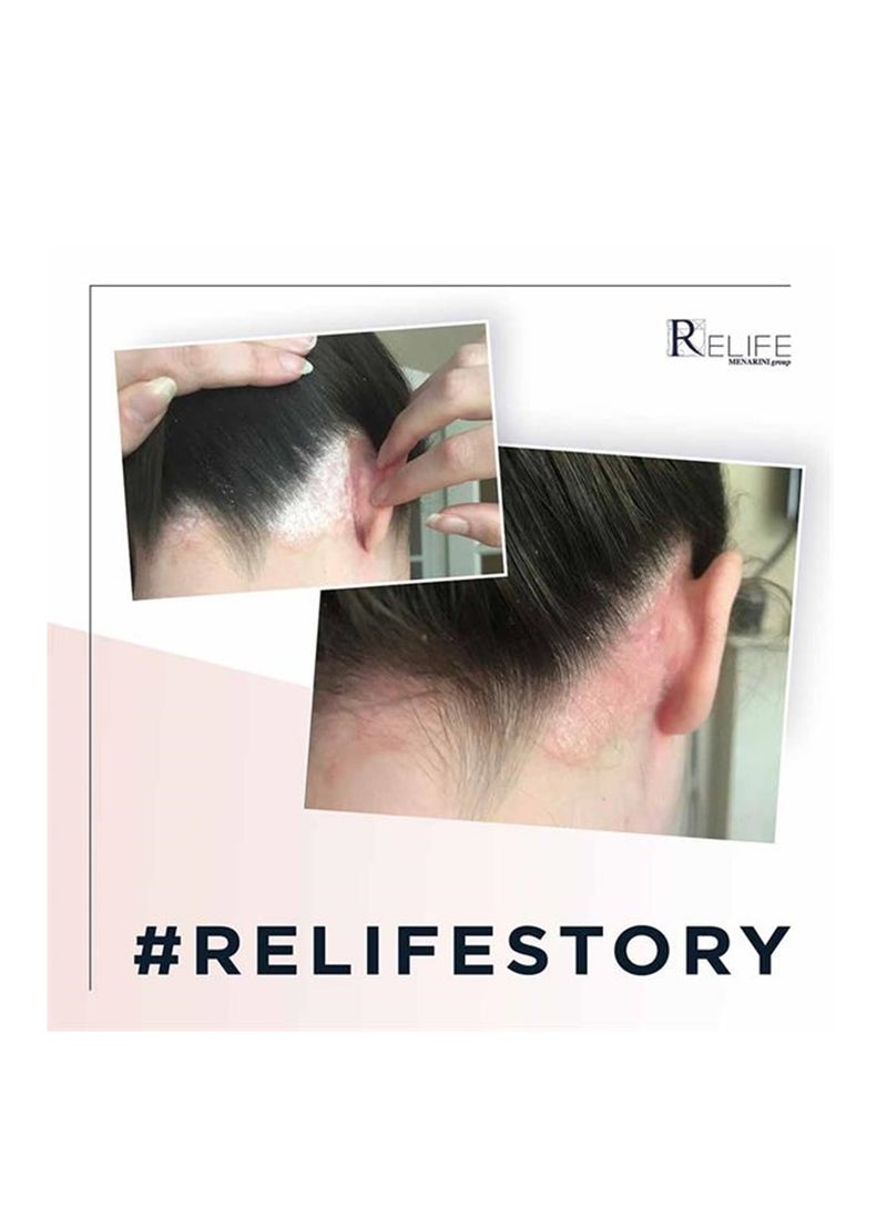 Relife U-Life 10% Ecofoam Scalp Spray 100Ml - Image 3