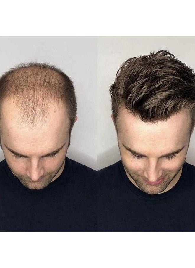 PRAVRAJYA - Australian Hair Patch For Men 100% Human Hair Natural Looking Pu Thin Front Lace Hair System/Patch/Toupee/Wig/Non Surgical Hair Replacement Solution (Brown Hair 8X5) - Image 1