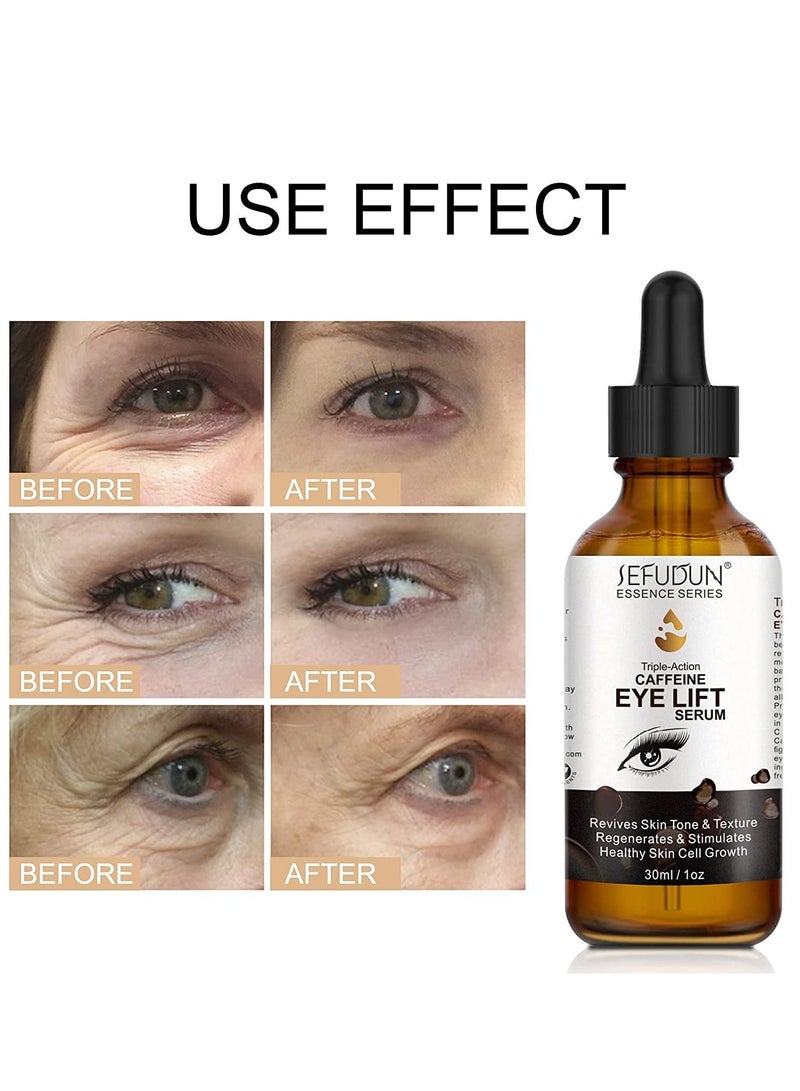 Sefudun مصل الكافيين للعين مع EGCG وفيتامين C وحمض الهيالورونيك والكولاجين وسيروم رفع العين بالكافيين يقلل من الانتفاخ والهالات السوداء تحت أكياس العين والتجاعيد والخطوط الدقيقة حول العينين مصل ثلاثي المفعول 30 مل - Image 3