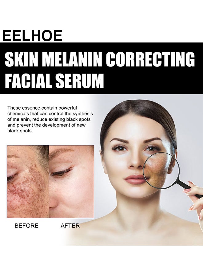 EELHOE Skin Melanin Correcting Facial Serum, Dark Spot Correcting Glow Serum, Mild And Not Stimulating For Any Part - Image 4