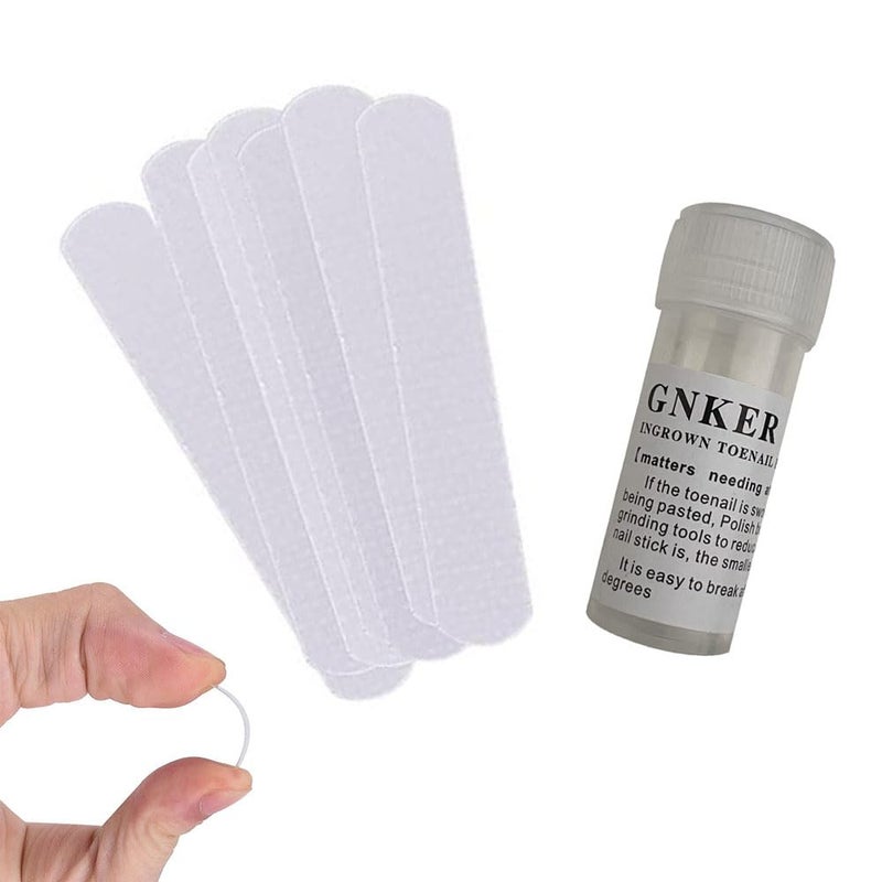 Gnker Ingrown Toenail Corrector Strips Brace 10pcs/bottle Straightener Clip Curved BS Brace Toenails Thick Correction Foot Tool - Image 2