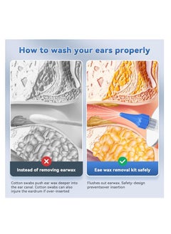 ARNOTEC Ear Wax Removal Tool, Manual Safe Ear Cleaner, Effective Ear Cleaning Kit, Earwax Removal Kit with Ear Basin and 10 Ear Tips  - Image 4