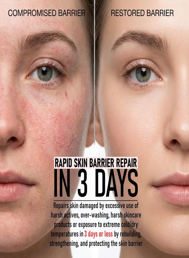 SKINLYTE صابون/سيروم سكينلايت المتطور لإصلاح حاجز البشرة بسرعة مع الكولاجين والكيراتين والببتيدات المتعددة وعوامل النمو - معزز السيراميدات وترطيب الماء الجزيئي الحقيقي - عبوة من قطعتين - Image 3