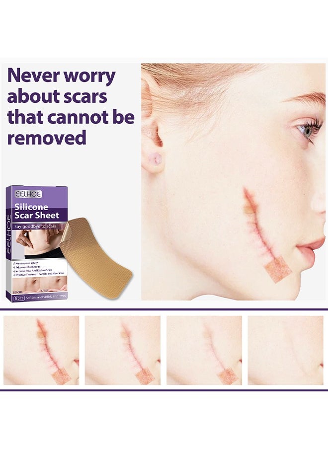 EELHOE - 1 Pack/8 PCS Silicone Scar Sheet, Made With Ultra-Thin Flexible Fabric Instead Of Rubber, For Scars Offer Comfort Protection, Effectively Soften, Flatten And Diminish New And Old Scars - Image 1