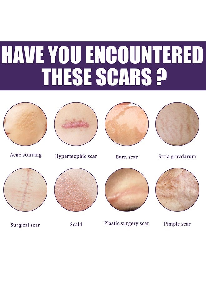 EELHOE - 1 Pack/8 PCS Silicone Scar Sheet, Made With Ultra-Thin Flexible Fabric Instead Of Rubber, For Scars Offer Comfort Protection, Effectively Soften, Flatten And Diminish New And Old Scars - Image 1
