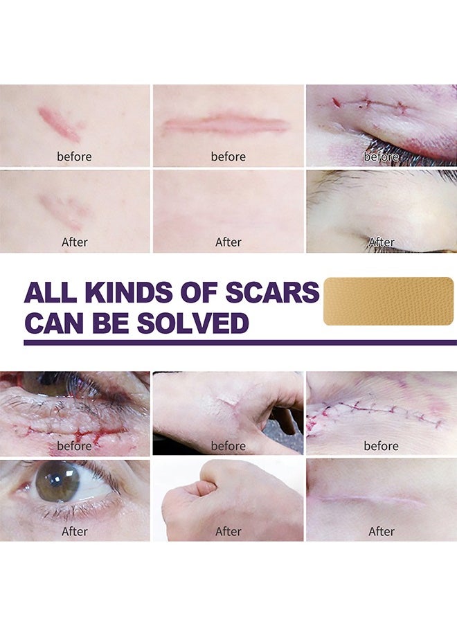 EELHOE - 1 Pack/8 PCS Silicone Scar Sheet, Made With Ultra-Thin Flexible Fabric Instead Of Rubber, For Scars Offer Comfort Protection, Effectively Soften, Flatten And Diminish New And Old Scars - Image 1