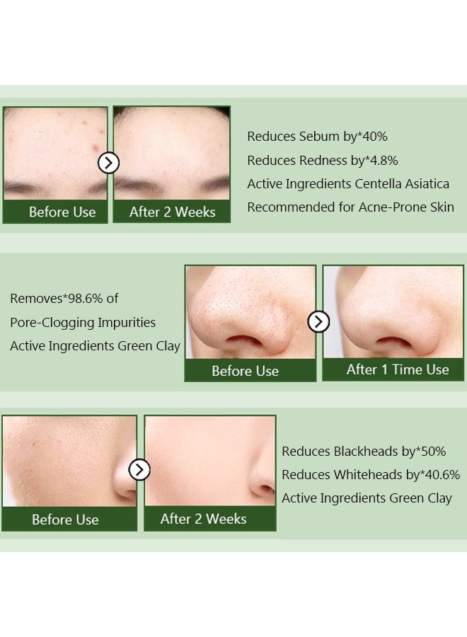جايسوينغ غسول قناع CICA، غسول للوجه، غسول للوجه 2 × 1، تركيبة غير مجففة مع نبات سنتيلا آسياتيكا للبشرة المعرضة لحب الشباب والحساسة، مرطب، للعناية بتنقية المسام، 120 جم - Image 5