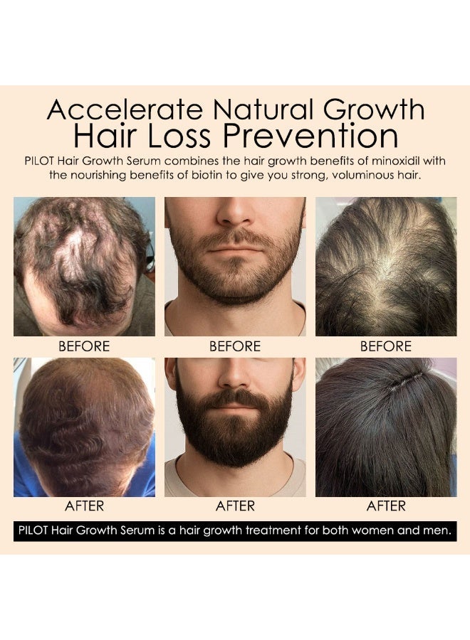 بايلوت سيروم بايلوت مينوكسيديل لنمو الشعر 60 مل | علاج تساقط الشعر للرجال والنساء | مع البيوتين ومستخلصات عشبية - Image 2