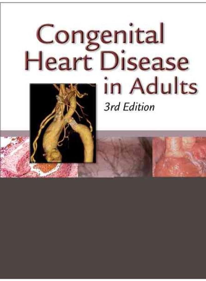 Congenital Heart Disease in Adults