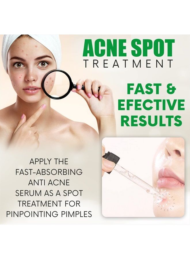 Antique Alive YoungWays Centella Cica Essence Korean Acne Serum for Face – Calming Anti Acne Blemish Ampule Redness Relief Skincare Facial Spot Treatment With Centella Asiatica Extract, Tea Tree Oil - Image 3